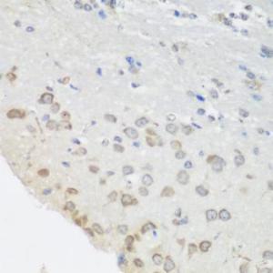 Immunohistochemistry of paraffin-embedded mouse brain using Anti-PUM1 Antibody (A6108) at dilution of 1:100 (40x lens)