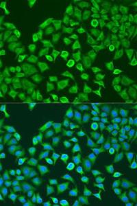 Immunofluorescence analysis of U2OS cells using Anti-PUM1 Antibody (A6108) at dilution of 1:100. Blue: DAPI for nuclear staining.