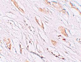 Anti-PEAR1 Rabbit Polyclonal Antibody