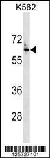 Anti-FZD7 Rabbit Polyclonal Antibody (Biotin)