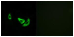 Immunofluorescence analysis of A549 cells using Anti-DCT Antibody. The right hand panel represents a negative control, where the antibody was pre-incubated with the immunising peptide