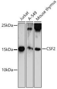 Anti-GM-CSF antibody