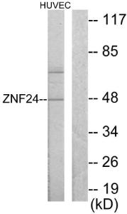 Anti-ZNF24 antibody