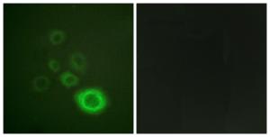 Immunofluorescence analysis of A549 cells using Anti-c-Met Antibody. The right hand panel represents a negative control, where the antibody was pre-incubated with the immunising peptide