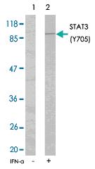 Anti-STAT3 Rabbit Polyclonal Antibody