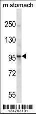 Anti-EPHA1 Rabbit Polyclonal Antibody (AP (Alkaline Phosphatase))