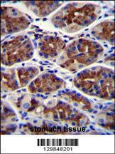 Anti-EPHX3 Rabbit Polyclonal Antibody