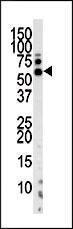 Anti-PINK1 Rabbit Polyclonal Antibody