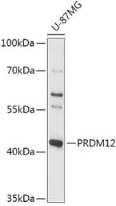 Western blot analysis of extracts of U-87MG cells, using Anti-PRDM12 Antibody (A306580) at 1:1,000 dilution The secondary antibody was Goat Anti-Rabbit IgG H&L Antibody (HRP) at 1:10,000 dilution Lysates/proteins were present at 25 µg per lane