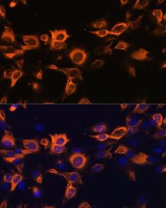 Anti-GM-CSF antibody