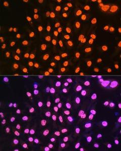 Immunofluorescence analysis of HeLa cells using Anti-hnRNP A1 Antibody [ARC0633] (A305568) at a dilution of 1:100 (40x lens). DAPI was used to stain the cell nuclei (blue).