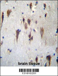 Anti-PCDH7 Rabbit Polyclonal Antibody (AP (Alkaline Phosphatase))