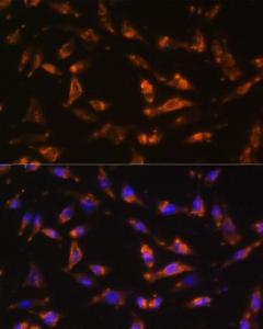 Anti-GM-CSF antibody