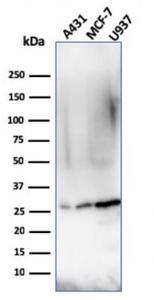 Western blot analysis of A431, MCF-7, and U937 cell lysates using Anti-Bcl-2 Antibody [rBCL2/796]