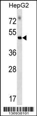 Anti-RAPGEF5 Rabbit Polyclonal Antibody