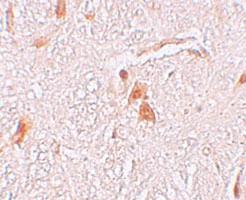 Anti-SHISA9 Rabbit Polyclonal Antibody