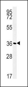 Anti-ATP1B1 Rabbit Polyclonal Antibody