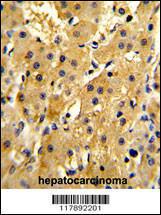 Anti-HPD Rabbit Polyclonal Antibody (AP (Alkaline Phosphatase))