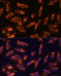 Anti-GM-CSF antibody