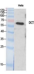 Western blot analysis of various cells using Anti-DCT Antibody