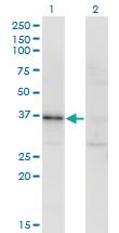 Anti-RBKS Mouse Monoclonal Antibody [clone: 3B4]