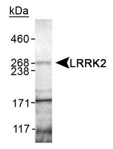 Anti-TOM70 Rabbit Polyclonal Antibody