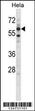 Anti-ADCK5 Rabbit Polyclonal Antibody (Biotin)