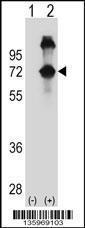 Anti-ASPSCR1 Rabbit Polyclonal Antibody (HRP (Horseradish Peroxidase))