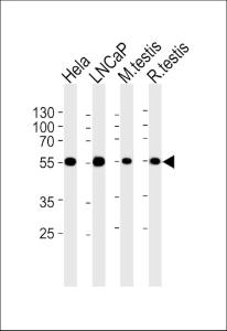 Anti-ULK3 Mouse Monoclonal Antibody [clone: 1404CT148.89.25]