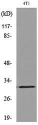 Western blot analysis of lysate from 4T1 cells using Anti-p57Kip2 (acetyl Lys278) Antibody