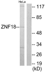 Antibody anti-ZNF18 100 µg