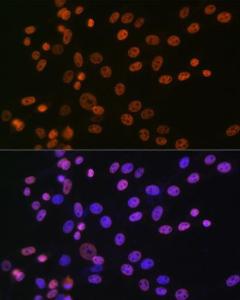 Immunofluorescence analysis of NIH-3T3 cells using Anti-hnRNP A1 Antibody [ARC0633] (A305568) at a dilution of 1:100 (40x lens). DAPI was used to stain the cell nuclei (blue).