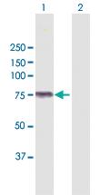 Anti-KLHL4 Rabbit Polyclonal Antibody