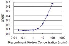 Anti-RBKS Mouse Monoclonal Antibody [clone: 3B4]