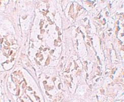 Anti-STOX2 Rabbit Polyclonal Antibody