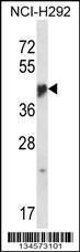 Anti-NR1I3 Rabbit Polyclonal Antibody