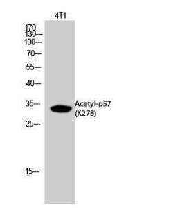 Western blot analysis of 4T1 cells using Anti-p57Kip2 (acetyl Lys278) Antibody