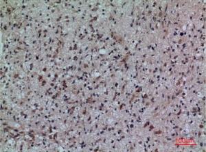 Immunohistochemical analysis of paraffin-embedded human brain using Anti-FCRL5 Antibody