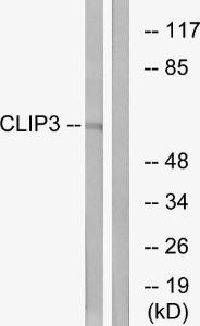 Western blot analysis of lysates from A549 cells using Anti-CLIP3 Antibody. The right hand lane represents a negative control, where the antibody is blocked by the immunising peptide