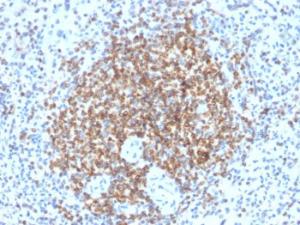 Immunohistochemical analysis of formalin-fixed, paraffin-embedded human spleen using Anti-Bcl-2 Antibody [BCL2/2210R]