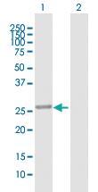 Anti-PBLD Mouse Polyclonal Antibody