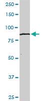 Anti-KLHL4 Rabbit Polyclonal Antibody