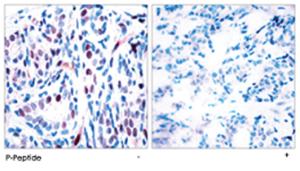 Anti-STAT3 Rabbit Polyclonal Antibody