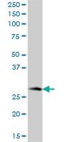 Anti-PBLD Mouse Polyclonal Antibody