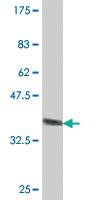 Anti-ABCA6 Mouse Polyclonal Antibody