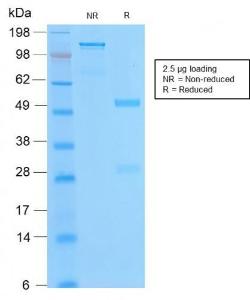 SDS-PAGE analysis of Anti-Bcl-2 Antibody [BCL2/2210R] under non-reduced and reduced conditions; showing intact IgG and intact heavy and light chains, respectively. SDS-PAGE analysis confirms the integrity and purity of the antibody