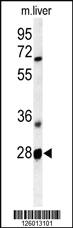 Anti-RTP2 Rabbit Polyclonal Antibody