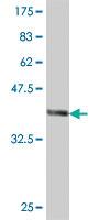 Anti-TNFRSF1A Mouse Polyclonal Antibody