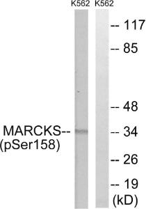 Western blot analysis of lysates from K562 cells treated with EGF 200ng/ml 30' using Anti-MARCKS (phospho Ser158) Antibody. The right hand lane represents a negative control, where the antibody is blocked by the immunising peptide.