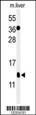 Anti-S100B Rabbit Polyclonal Antibody